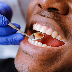 Dentistry for Life | Dentures, Digital Radiography and Periodontal Treatment
