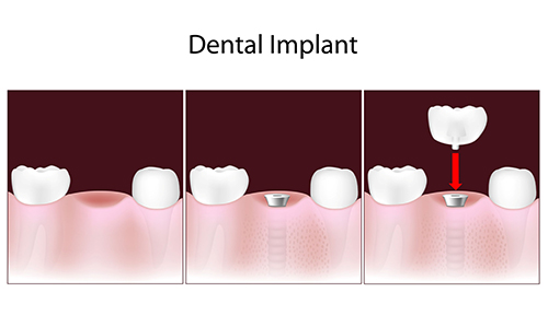 Dentistry For Life