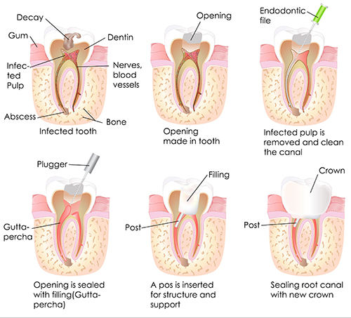 Dentistry For Life